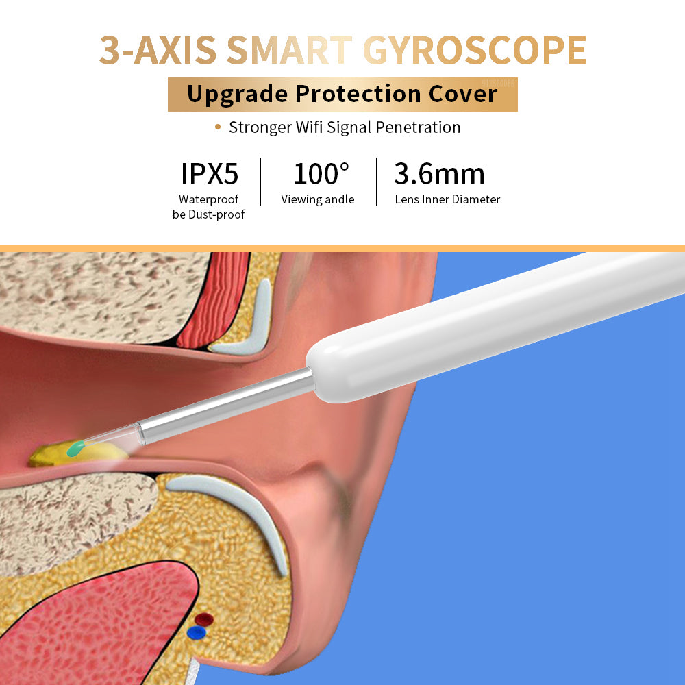 NE3 Ear Cleaner Otoscope Ear Wax Removal Tool With Camera LED Light Wireless Ear Endoscope (For iPhone) - Baby Dotz