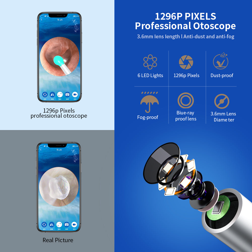 NE3 Ear Cleaner Otoscope Ear Wax Removal Tool With Camera LED Light Wireless Ear Endoscope (For iPhone) - Baby Dotz